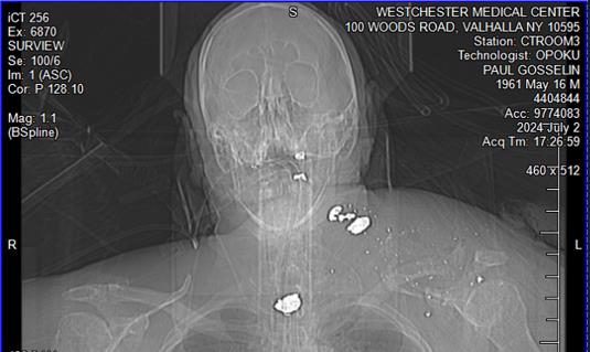 Paul Gosselin Life Threatening Wounds